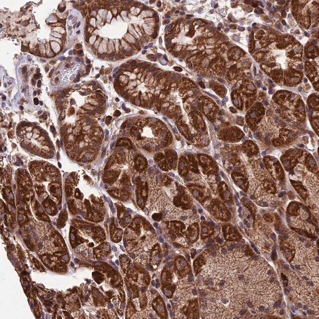 Anti-RNF17 antibody produced in rabbit