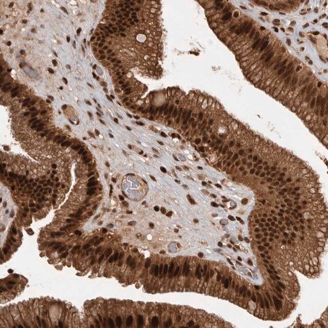 Anti-RPS6KA4 antibody produced in rabbit