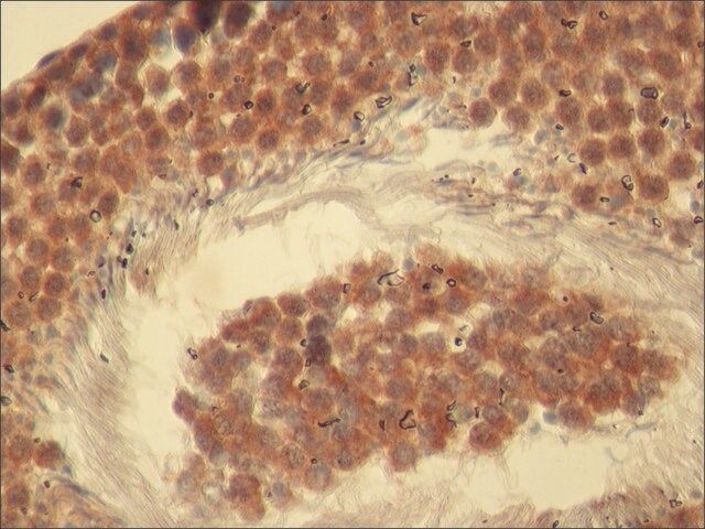Anti-RICTOR antibody produced in rabbit
