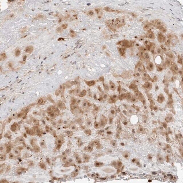 Anti-RNF146 antibody produced in rabbit