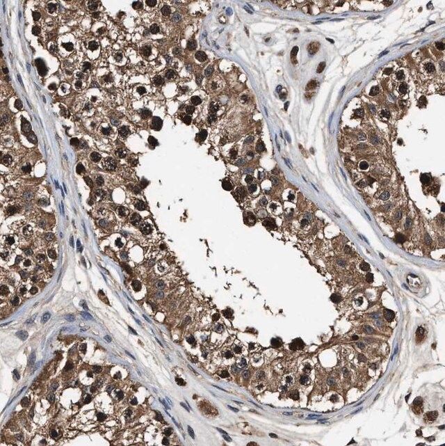 Anti-RNF114 antibody produced in rabbit