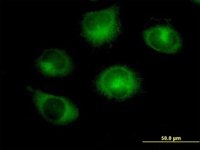 Anti-RABGAP1 antibody produced in mouse