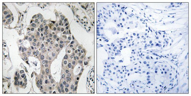 Anti-RAB3GAP2 antibody produced in rabbit