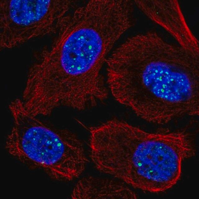 Anti-RASL11A antibody produced in rabbit