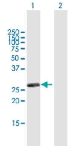 Anti-RASSF3 antibody produced in mouse