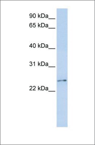 Anti-RCAN3 antibody produced in rabbit