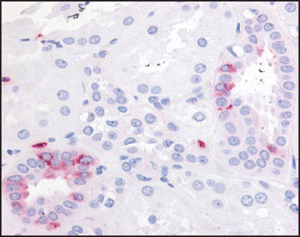 Anti-PTGER2 (AB1) antibody produced in rabbit