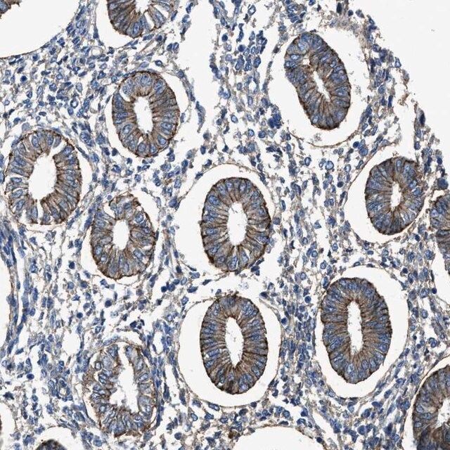 Anti-PTGFRN antibody produced in rabbit