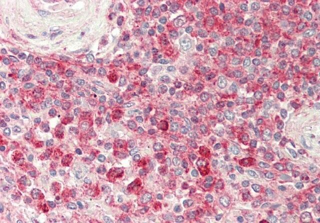 Anti-PTDSS1 antibody produced in rabbit