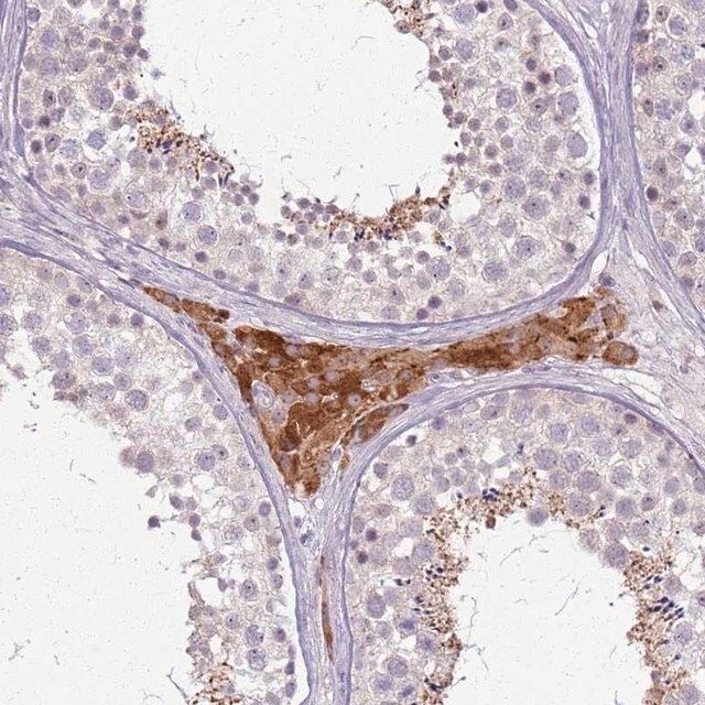 Anti-PTCHD3 antibody produced in rabbit