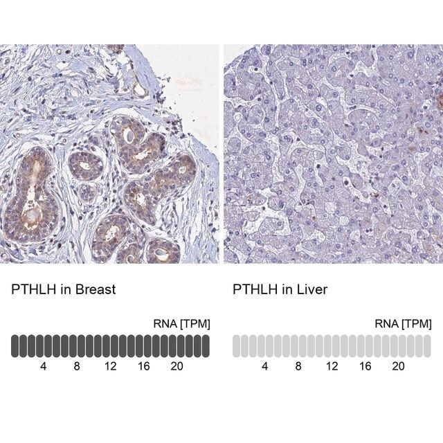 Anti-PTHLH antibody produced in rabbit
