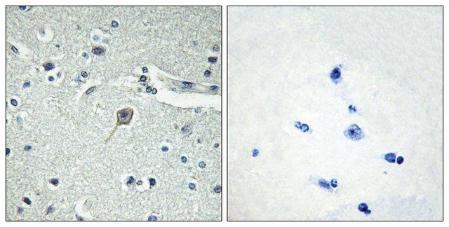 Anti-PTHR1 antibody produced in rabbit