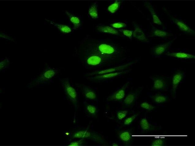 Anti-PTMS antibody produced in rabbit