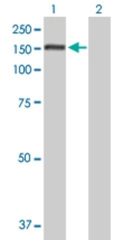 Anti-PUM1 antibody produced in mouse