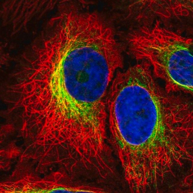 Anti-PTPN18 antibody produced in rabbit