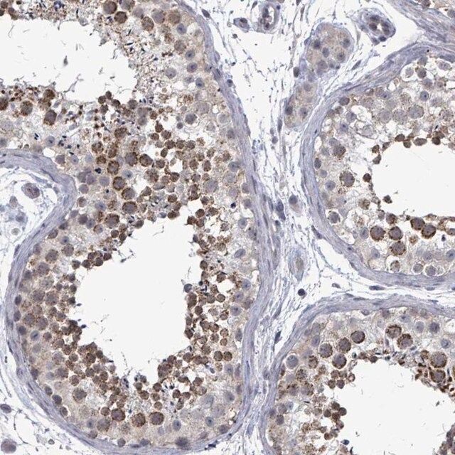 Anti-PTPN20 antibody produced in rabbit