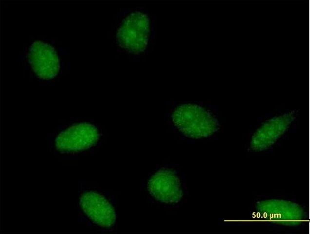 Anti-PTS antibody produced in mouse