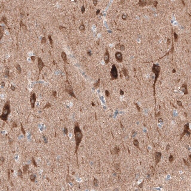Anti-PTPRD antibody produced in rabbit