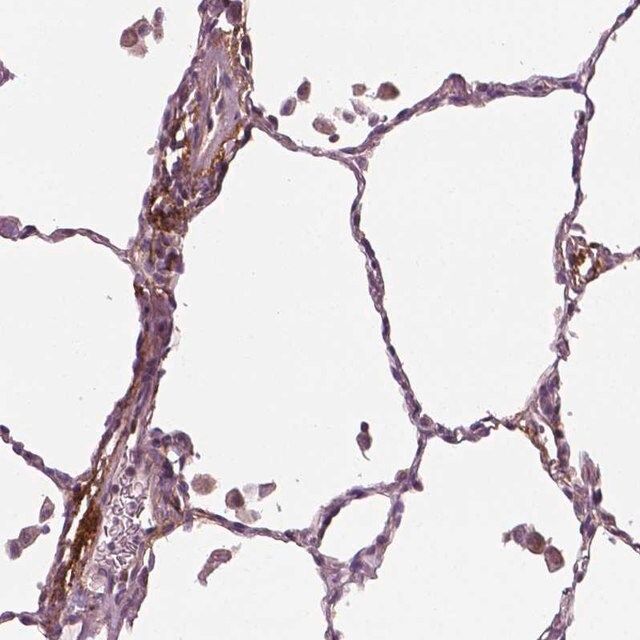 Anti-PTX3 antibody produced in rabbit