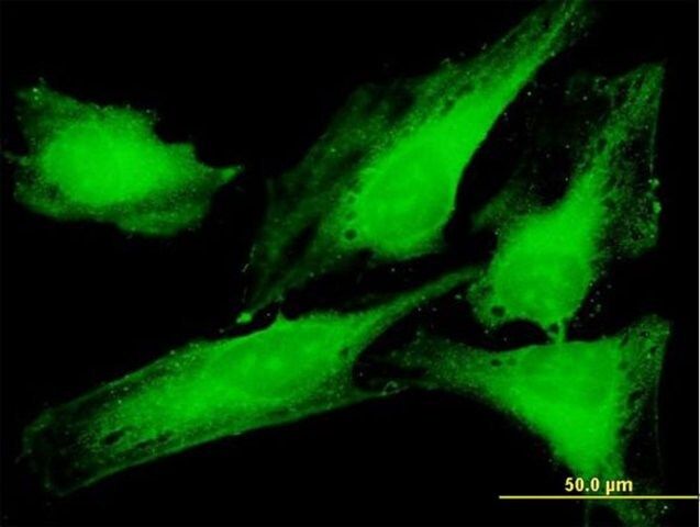 Anti-PTTG1IP antibody produced in mouse