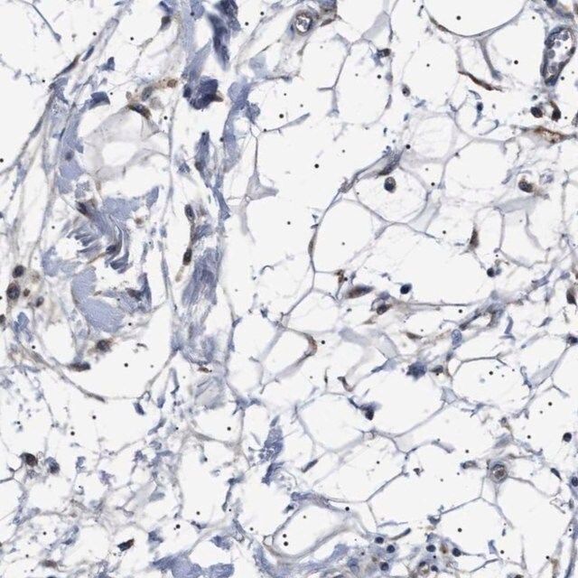 Anti-PTRH1 antibody produced in rabbit