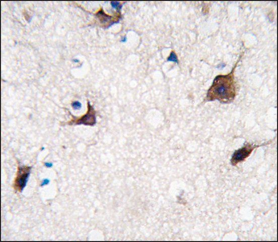 Anti-PUM1 (Y1123) antibody produced in rabbit