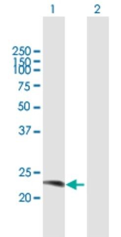 Anti-RAB38 antibody produced in mouse