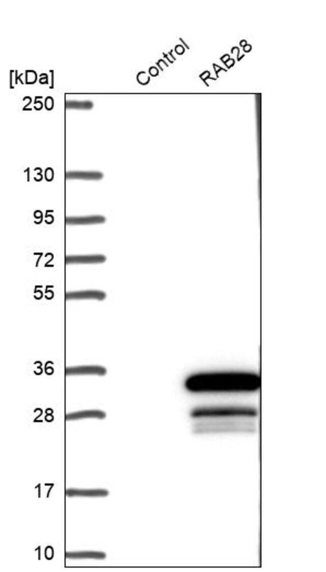 Anti-RAB28 antibody produced in rabbit