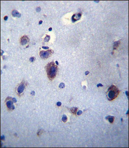 ANTI-PRLH (CENTER) antibody produced in rabbit