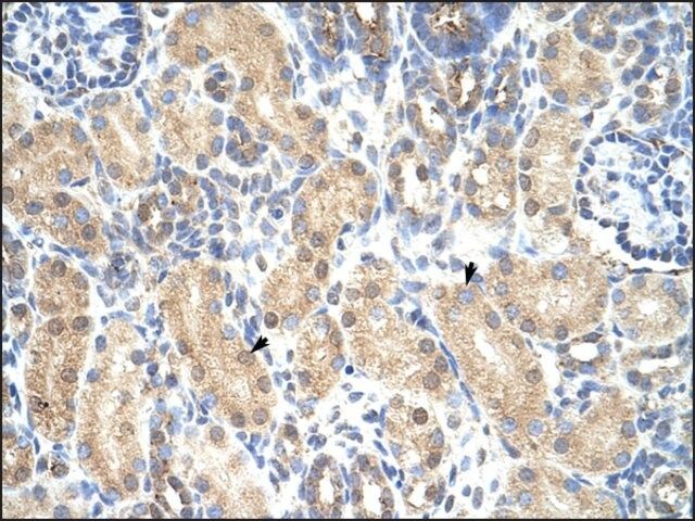 Anti-PRMT1 antibody produced in rabbit