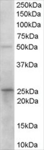 Anti-Prostaglandin Dehydrogenase 1 antibody produced in goat