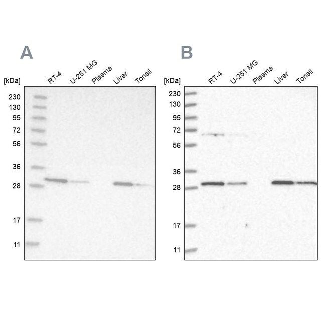 Anti-PROSC antibody produced in rabbit
