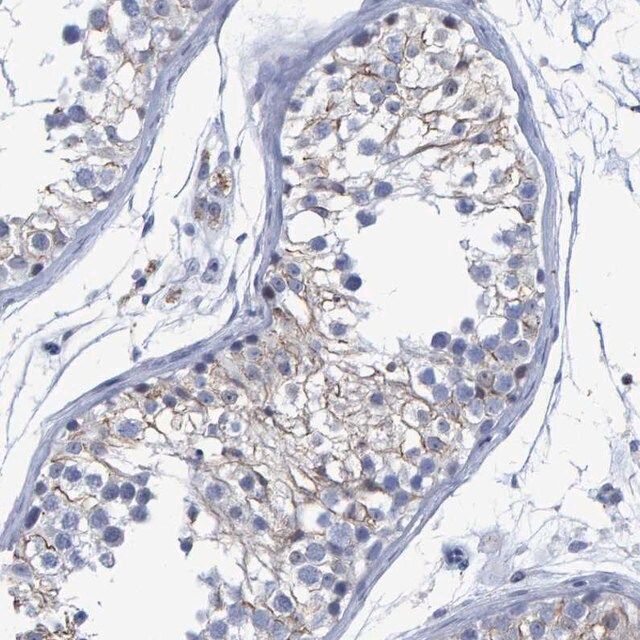 Anti-PROCA1 antibody produced in rabbit
