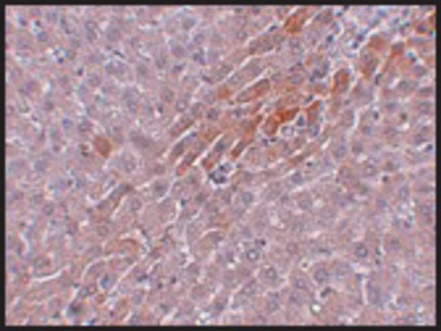 Anti-PROSAPIP2 antibody produced in rabbit