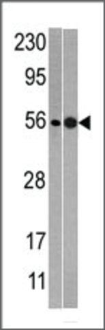Anti-PRP17 (center R178) antibody produced in rabbit