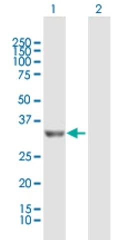 Anti-PROSC antibody produced in mouse