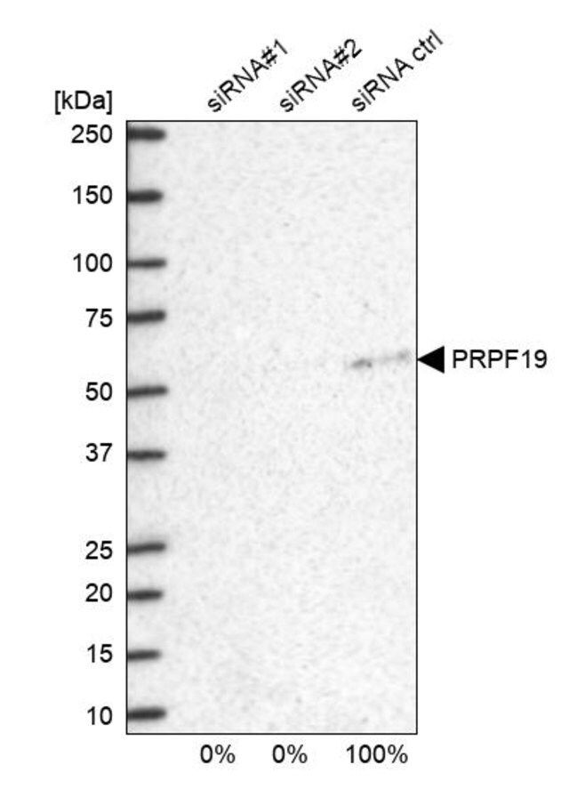 Anti-PRPF19 antibody produced in rabbit