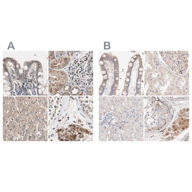 Anti-PROS1 antibody produced in rabbit