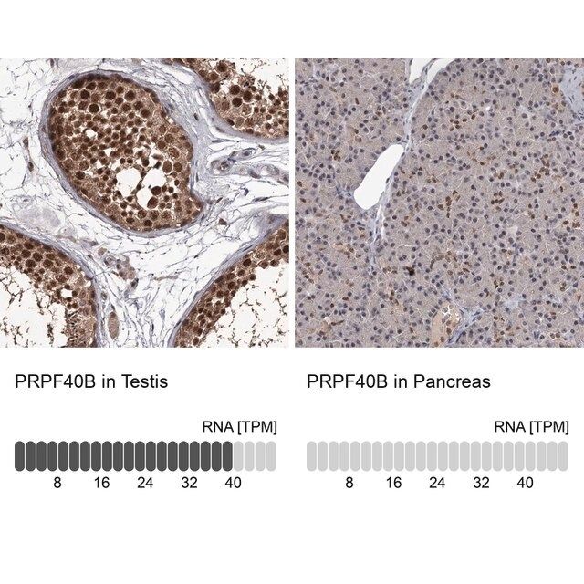 Anti-PRPF40B antibody produced in rabbit