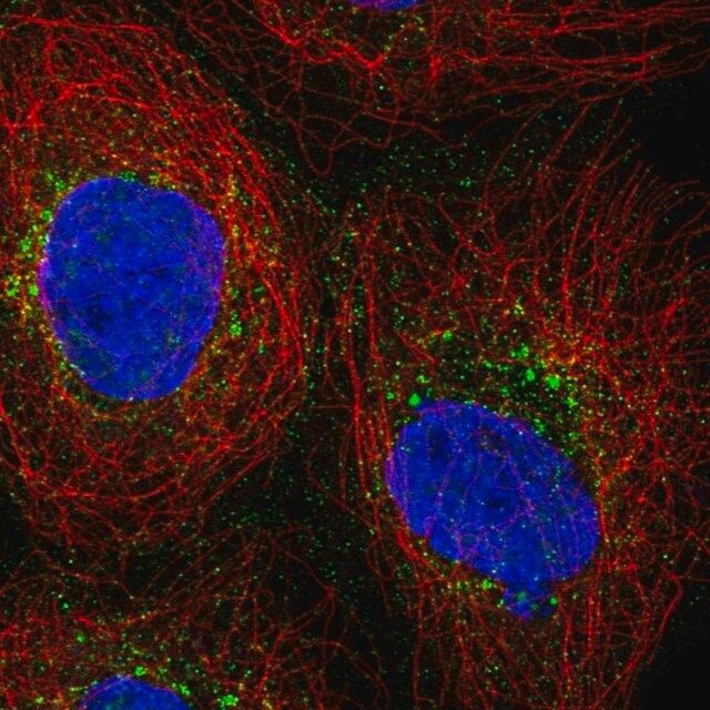 Anti-PRPS2 antibody produced in rabbit