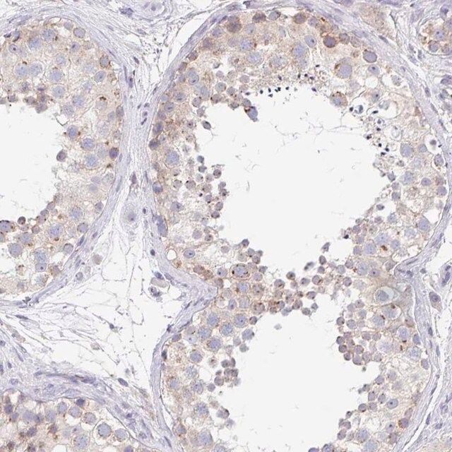 Anti-PROSER3 antibody produced in rabbit