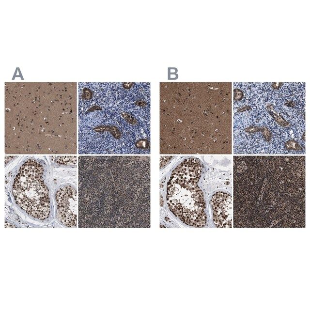 Anti-PRPF4 antibody produced in rabbit