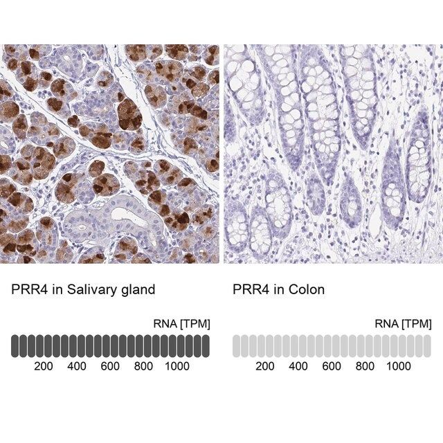 Anti-PRR4 antibody produced in rabbit