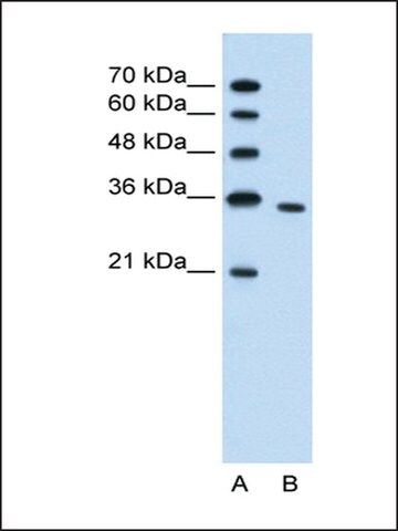 Anti-PRPS2 antibody produced in rabbit