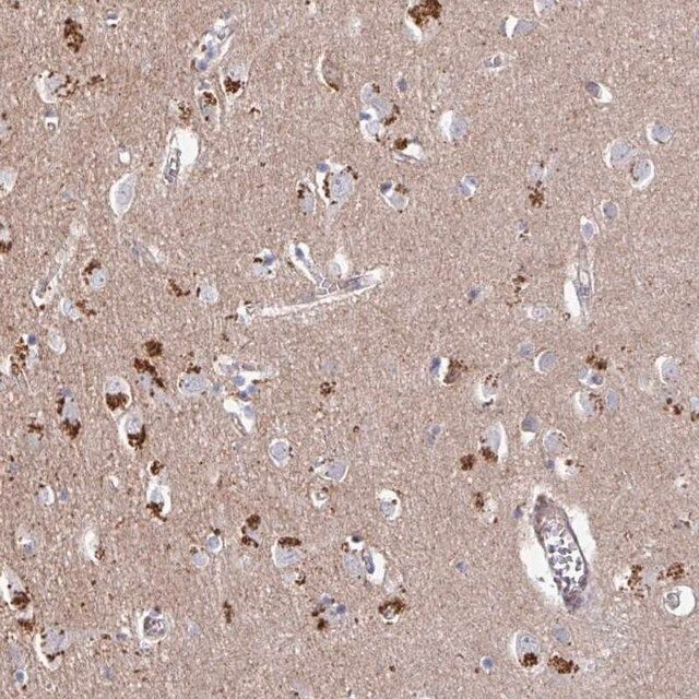 Anti-PRR5 antibody produced in rabbit