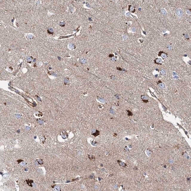 Anti-PSEN1 antibody produced in rabbit