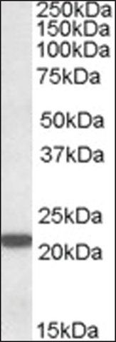 Anti-PSMB8 (C-terminal) antibody produced in goat