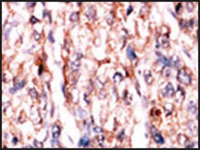 Anti-PSKH1 (N-term H70) antibody produced in rabbit