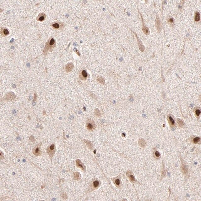 Anti-PSMD14 antibody produced in rabbit