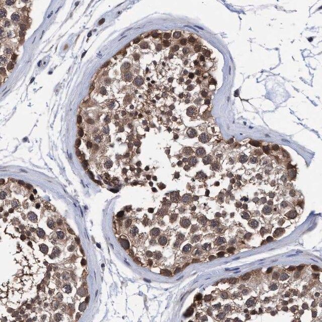 Anti-PSMD12 antibody produced in rabbit